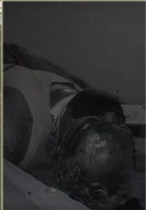 bir hospital case ,,kaidi ko mritu